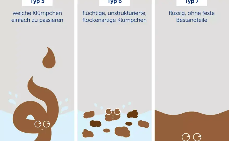 Gesunder Stuhlgang - Was ist normal und wann zum Arzt?